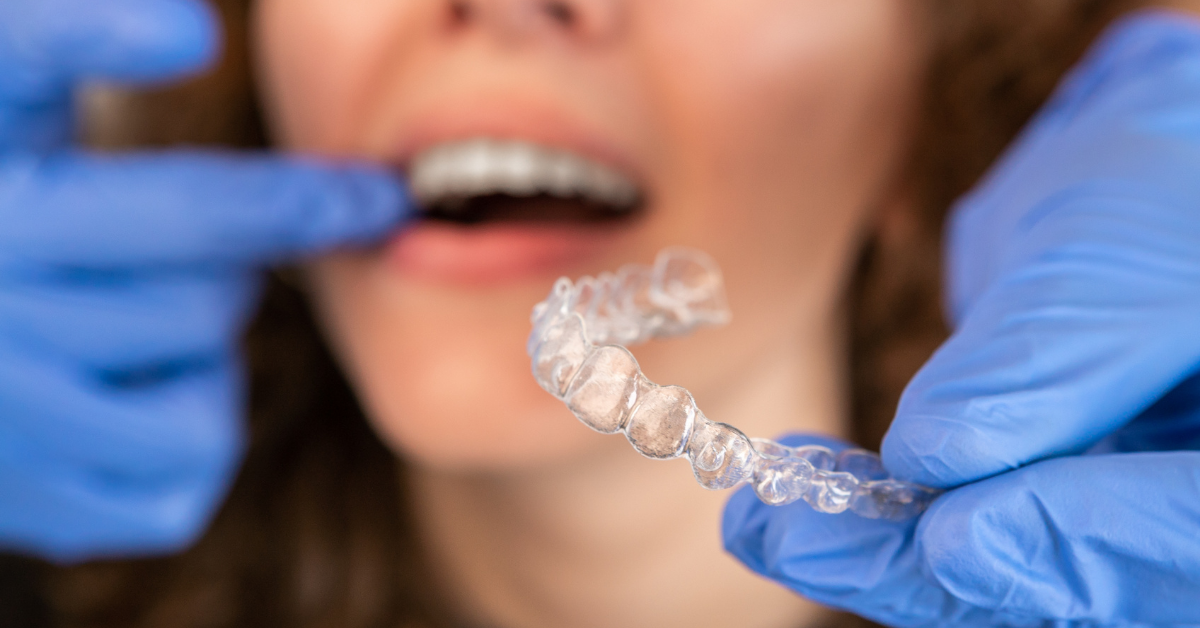 Invisalign clear aligners at Sikora Dental Chicago